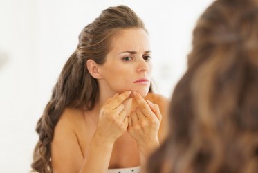 Verdades y mentiras sobre el acné