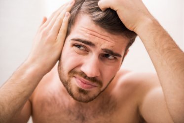 Alopecia: esto es todo lo que tienes que saber sobre la calvicie masculina