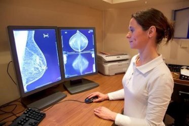 Mamografías, para qué sirven y cuándo hacerlas